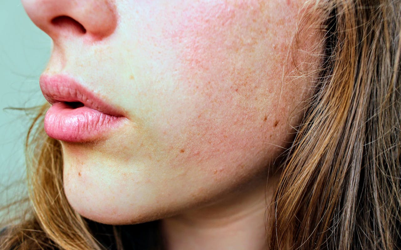 Skincare 