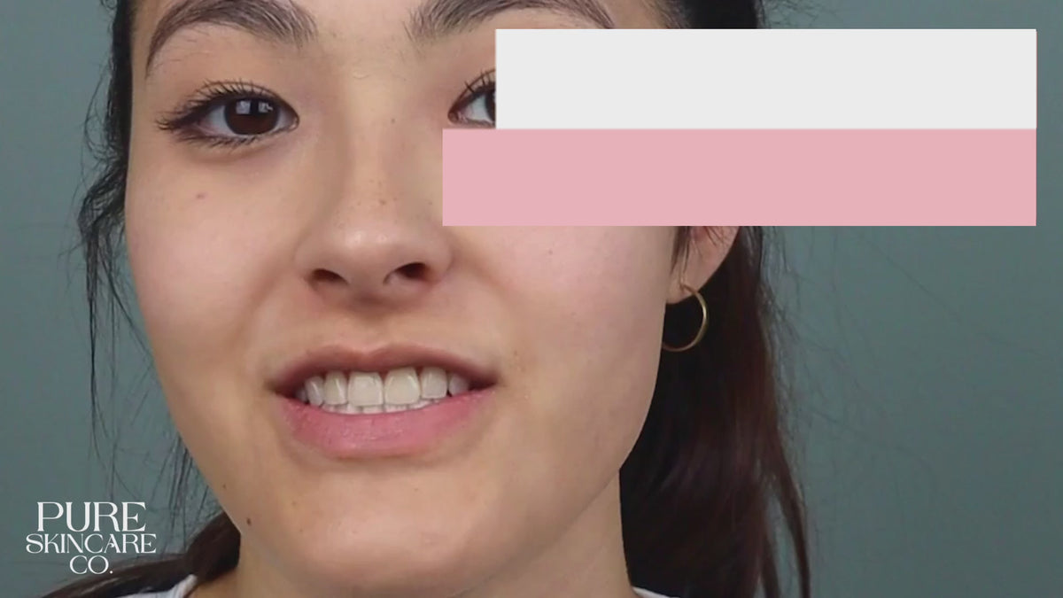 t-home microdermabrasion device removing dead skin for smoother texture